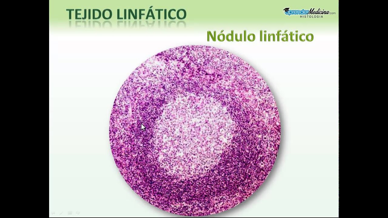 Tejido Linfático. Introducción
