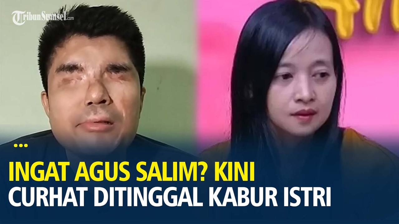 Ingat Agus Salim Korban Penyiraman Air keras? Kini Curhat Ditinggal Kabur Istri