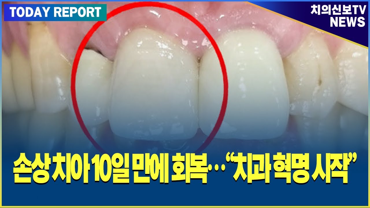 손상된 치아 복원하는 '젤'