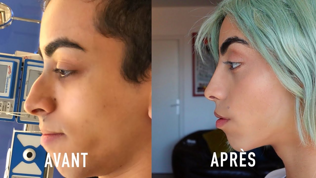 J'AI REFAIT MON NEZ !