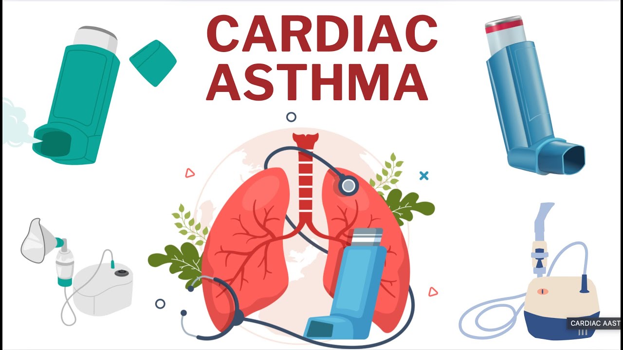 CARDIAC ASTHMA  - causes, signs symptoms, management, nursing intervention