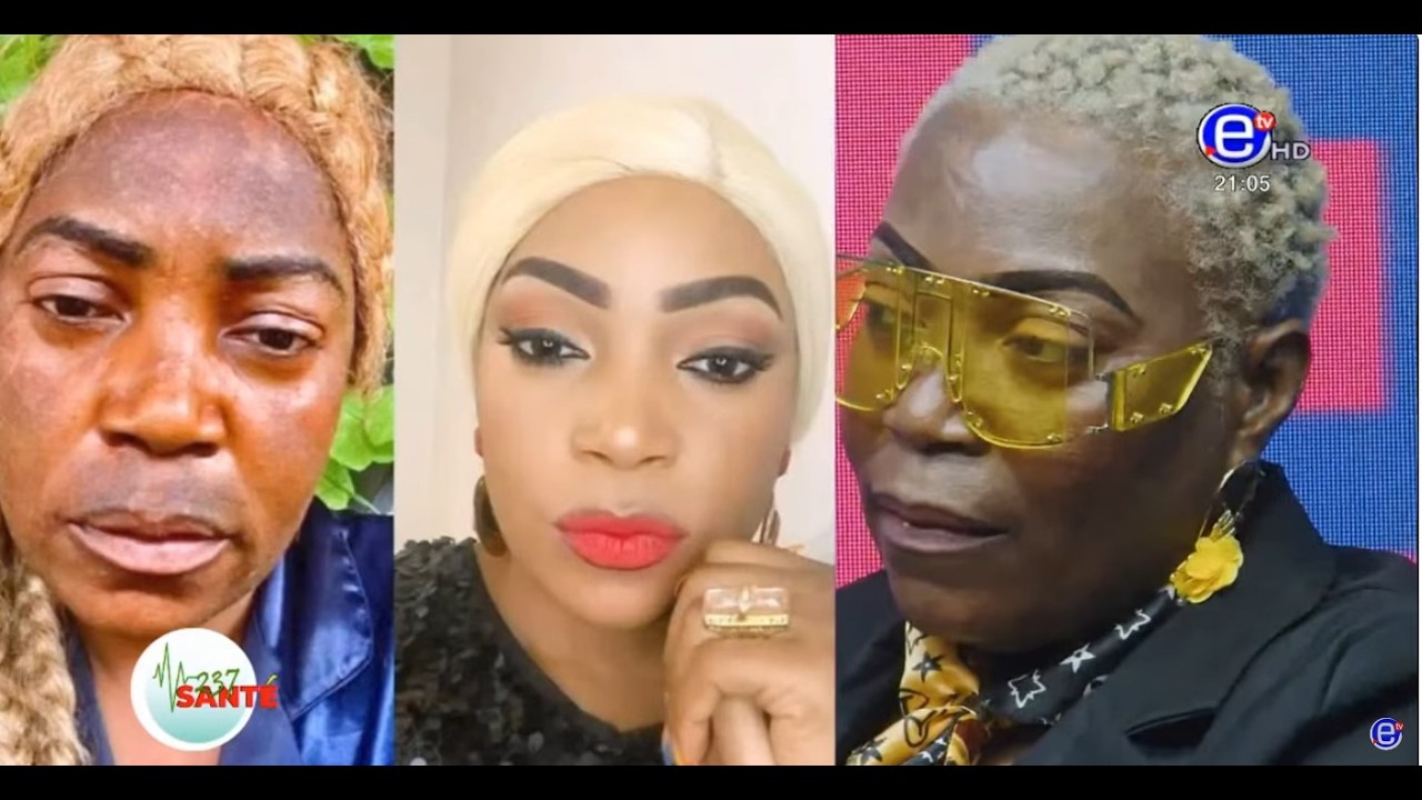 DÉPIGMENTATION:NJANSANG AU CAMEROUN| AKONTI AU TOGO|COBWACA AU CONGO| ET TCHATCHOLI EN CÔTE D'IVOIRE