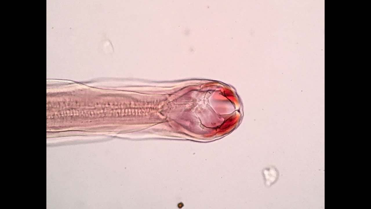 Ancylostoma braziliense ♀