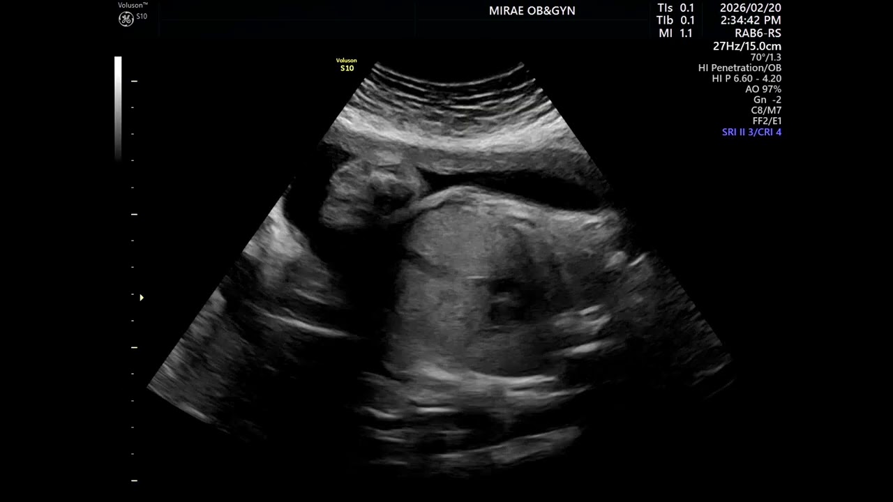 잘크고있는 우리집둘찌🩷🩷