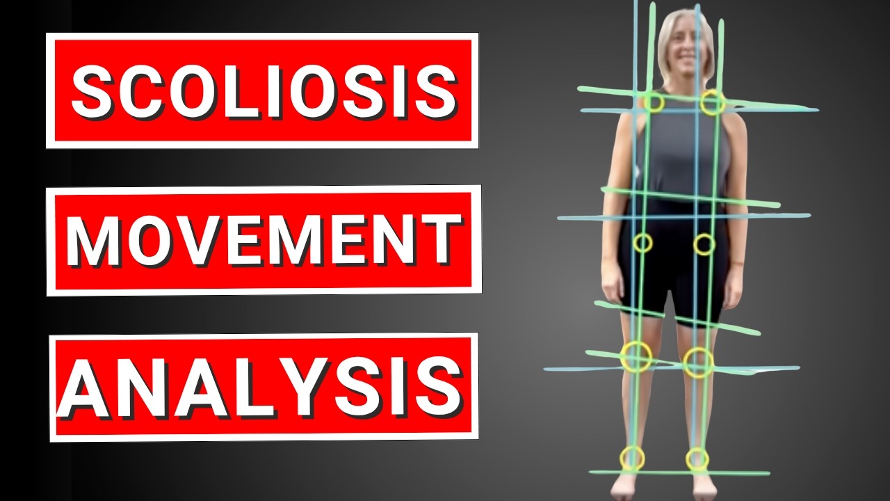 The Hidden Reason Scoliosis Causes Hip and Knee Pain