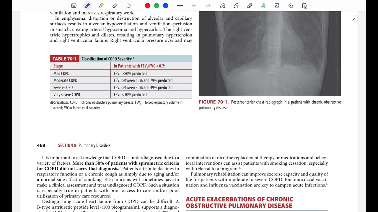 Asthma and copd