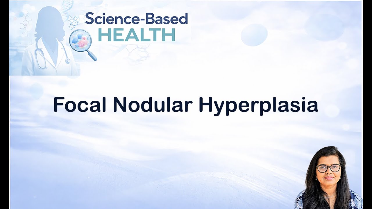 Understanding Focal Nodular Hyperplasia of the Liver