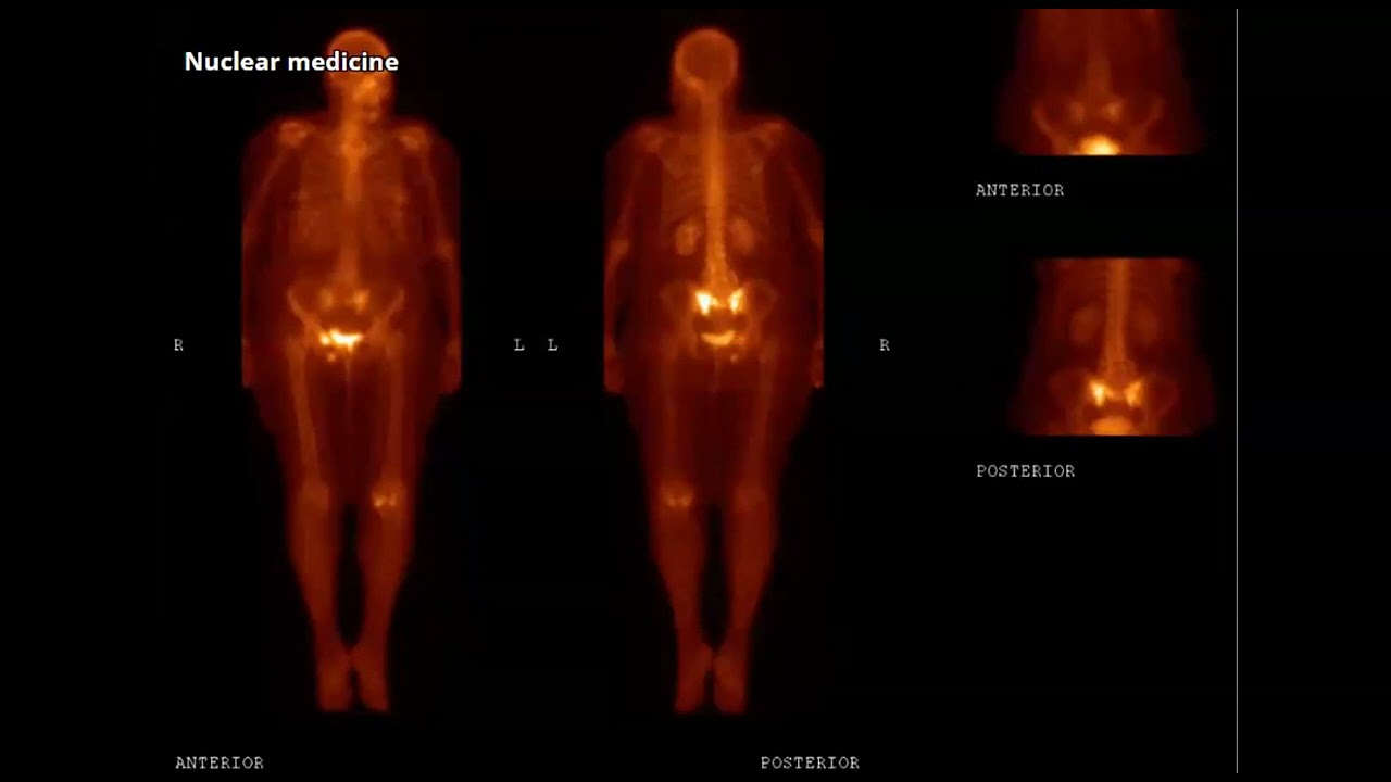 Nuclear cases for FRCR