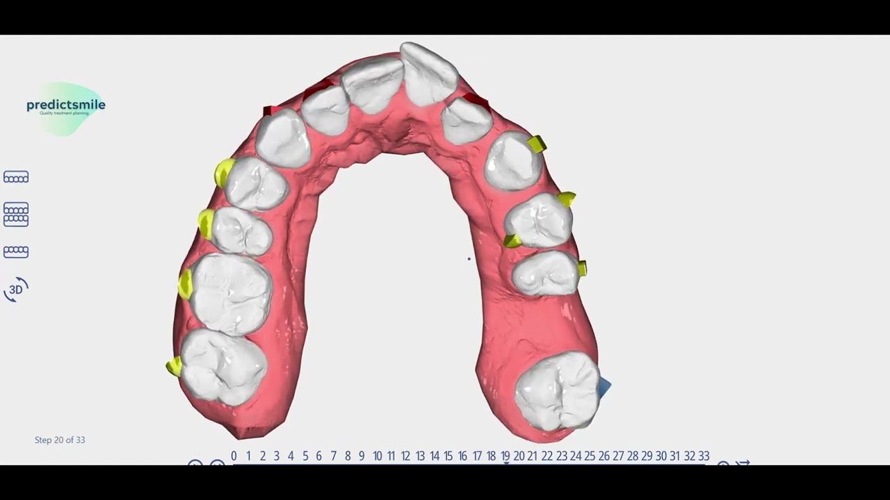 Onyxceph Smart Staging