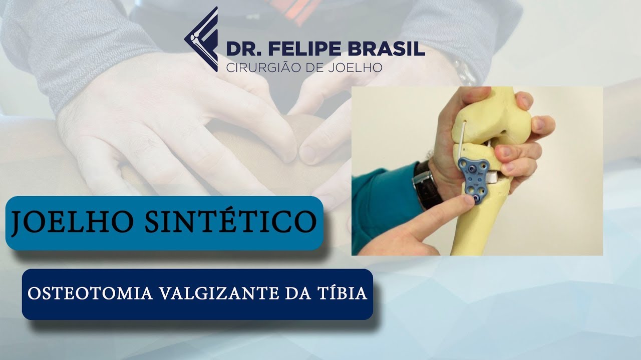 OSTEOTOMIA DA TÍBIA - WORKSHOP