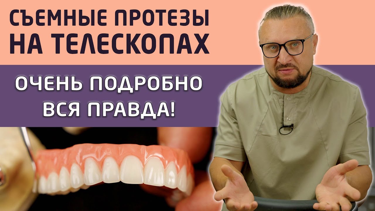 Показываем съемные зубные протезы Кандулор на телескопах, а так же процесс их установки пациенту.