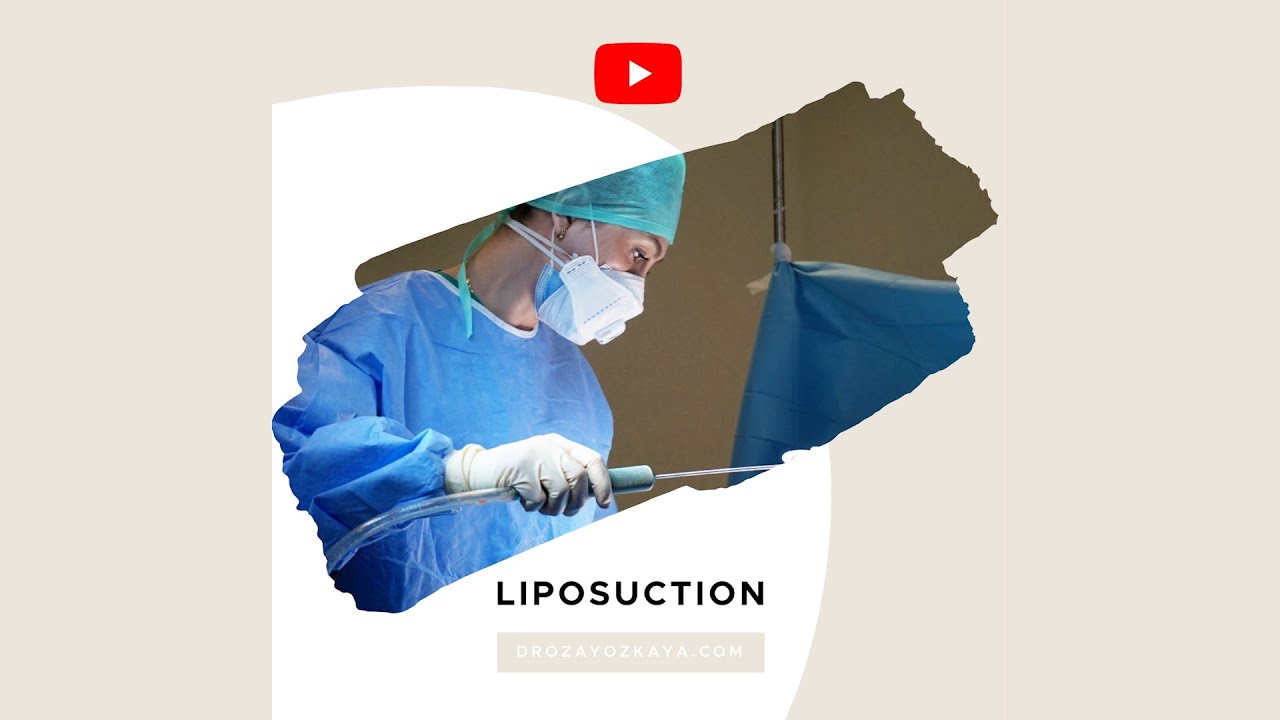 Liposuction