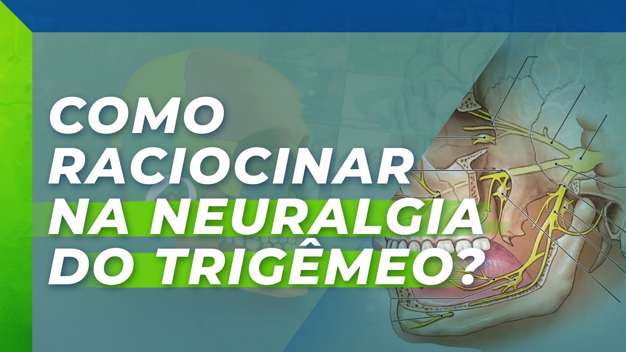 COMO RACIOCINAR NA NEURALGIA DO TRIGÊMEO