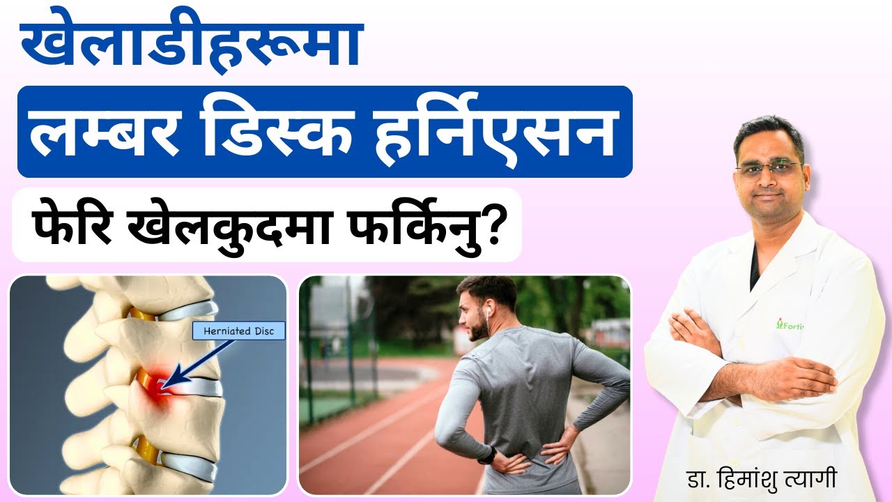 खेलाडीहरूमा लम्बर डिस्क हर्निएसन फेरि खेलकुदमा फर्किनु? | Lumbar Disc Herniation in Athletes ?