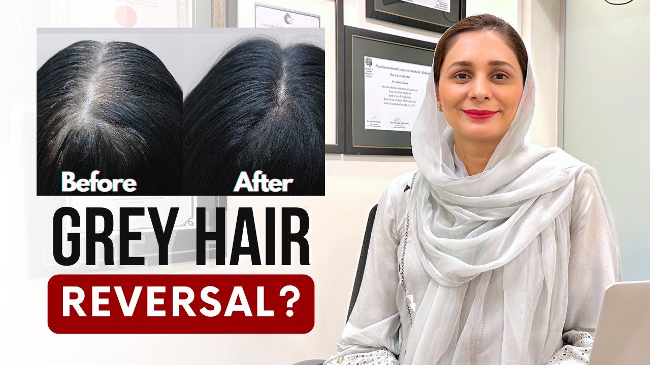 Can you reverse grey hair? Dr. Amna explains!