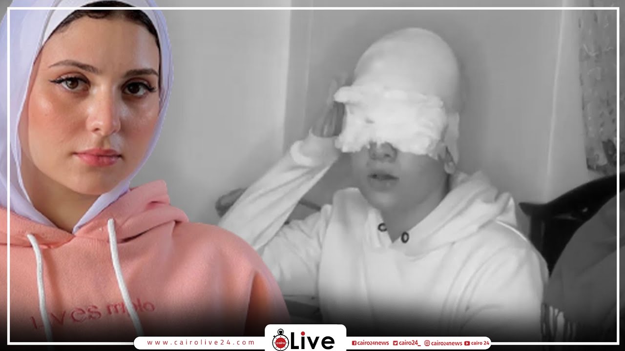 بنتك اتعمت.. سارة محمد وعائلتها يروون تفاصيل إصابتها في حادث الطريق الصحراوي