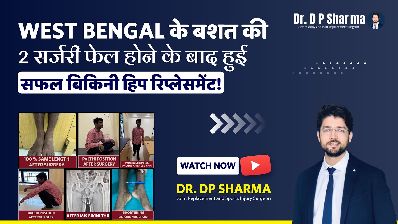 Successful MIS BIKINI Hip Replacement of Patient From West-Bengal | Traumatic AVN Treatment In INDIA