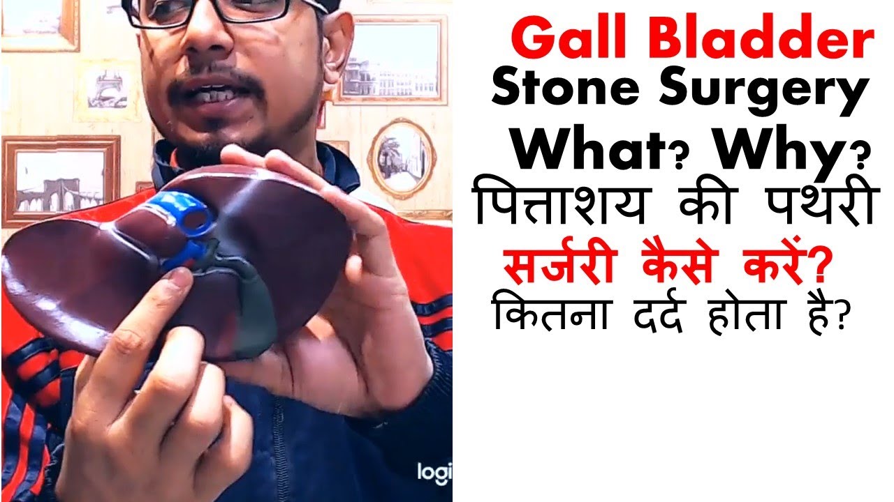 Gall bladder surgery process