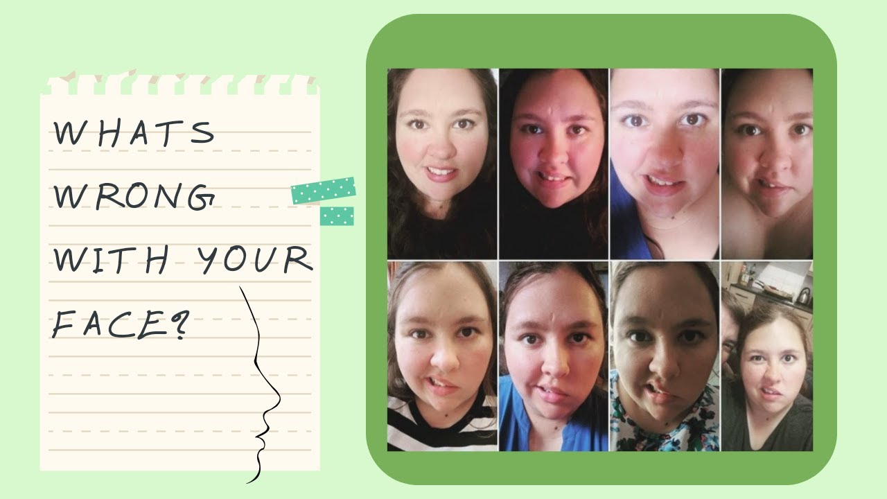 Bells Palsy and Trigeminal Neuralgia - My story!