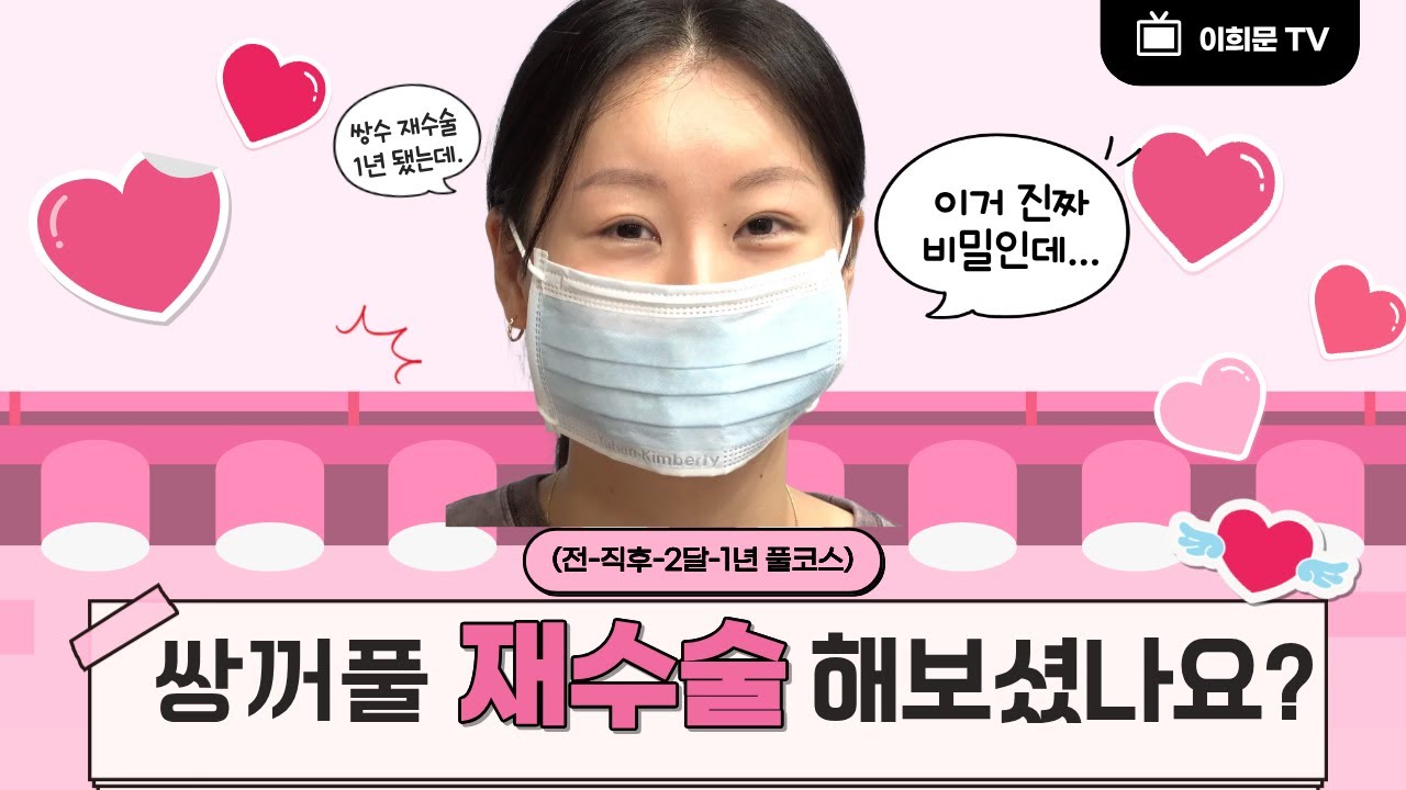 쌍꺼풀 재수술 1년 뒤엔 얼마나 자연스러울까? (전-직후-2달-1년 풀코스)