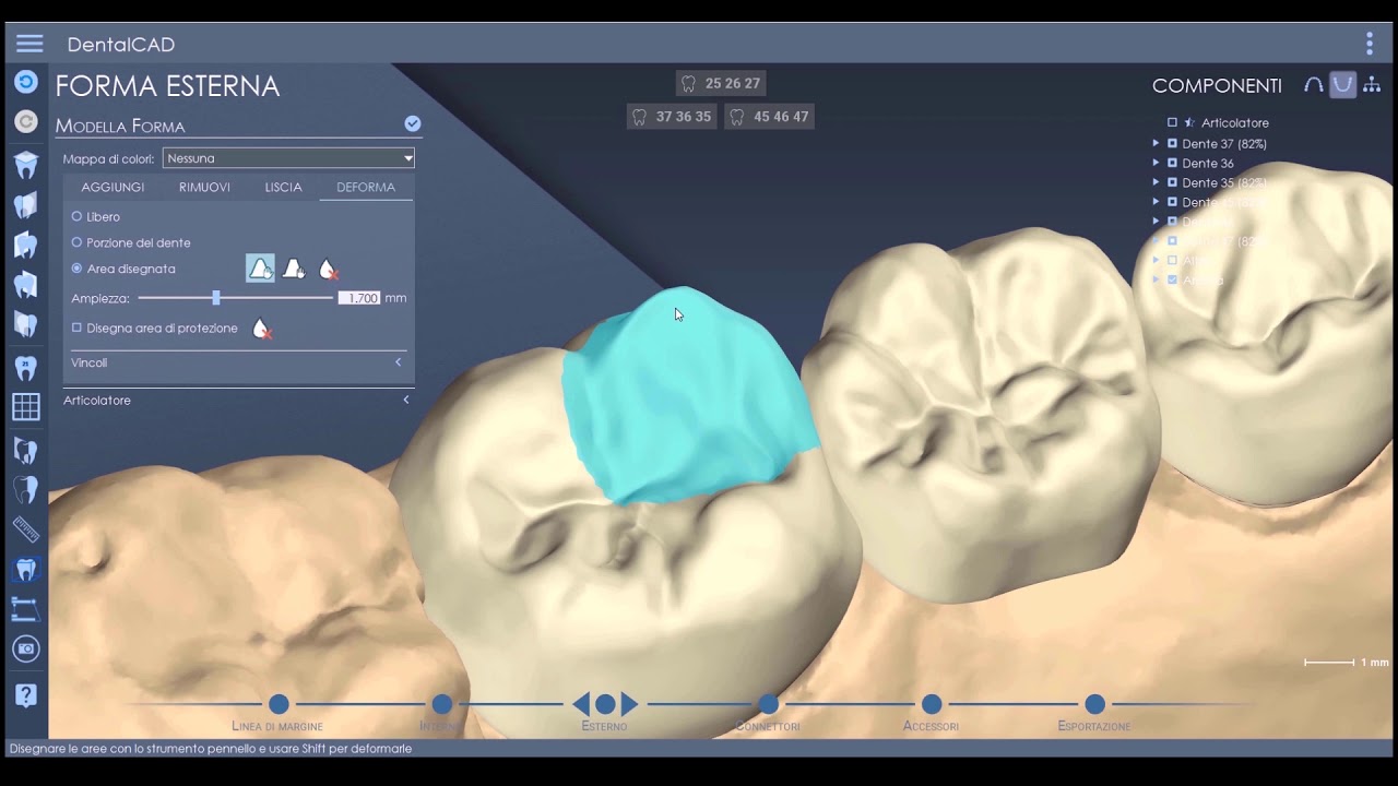 DentalCad 2020 - Novità pt.1
