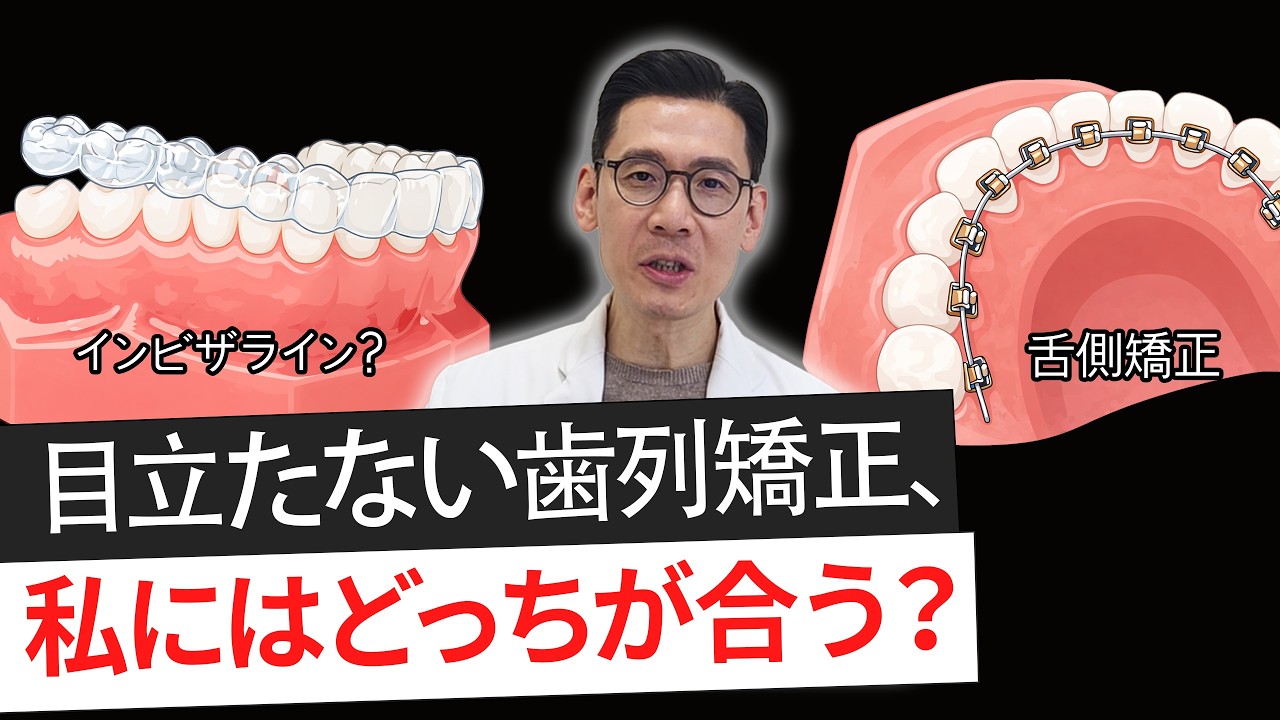 目立たない歯列矯正なら？インビザライン vs 裏側矯正、どっちが自分に合う？ #目立たない歯列矯正#インビザライン#裏側矯正#透明マウスピース矯正