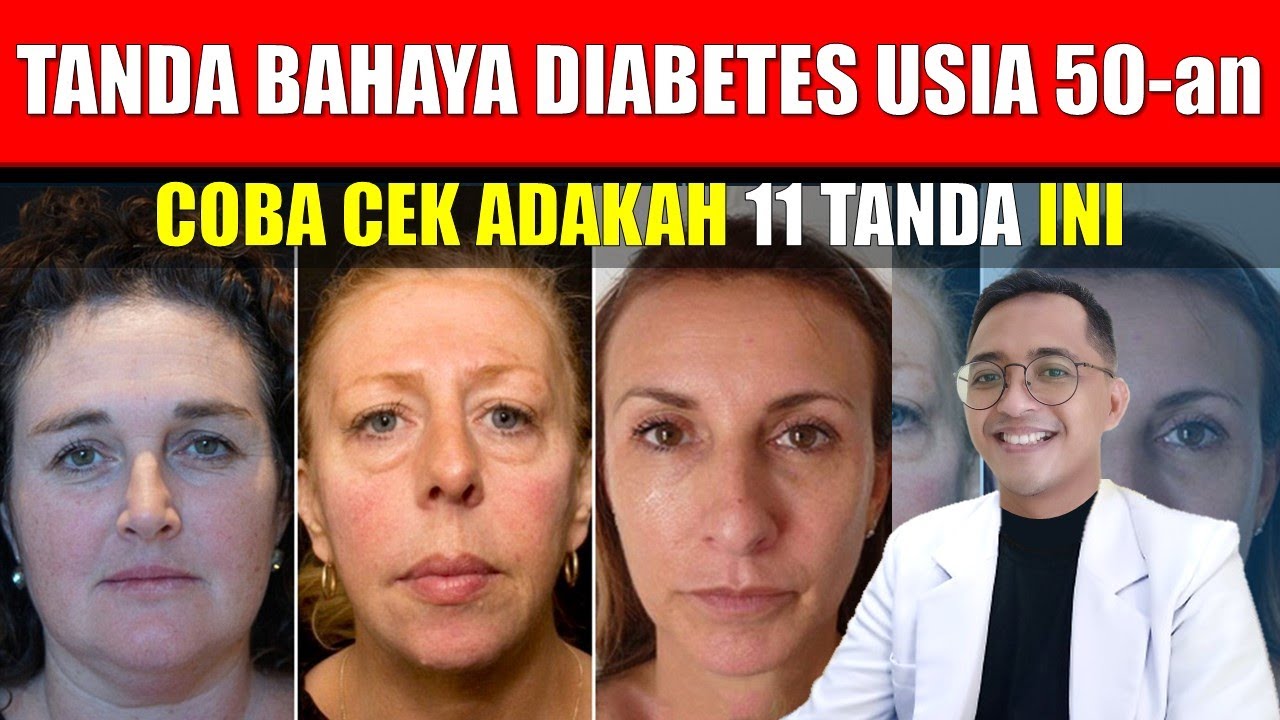 Diabetes di Usia 50an: Waspadai Tanda Bahayanya!