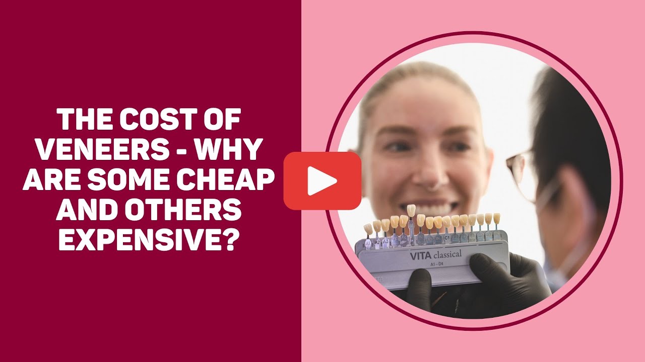 The Cost of Veneers - Why are some cheap and others expensive?