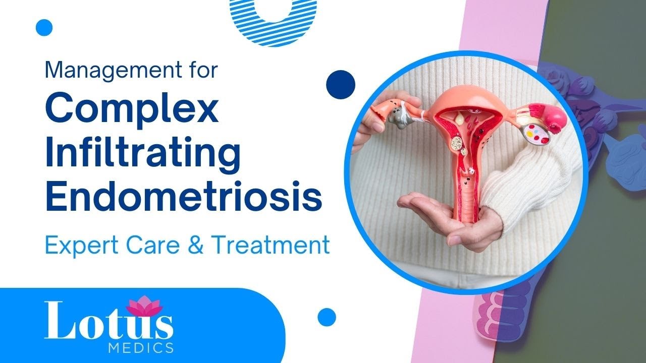 Management for Complex / Deep Infiltrating Endometriosis | Expert Treatment & Care - Lotus Medics