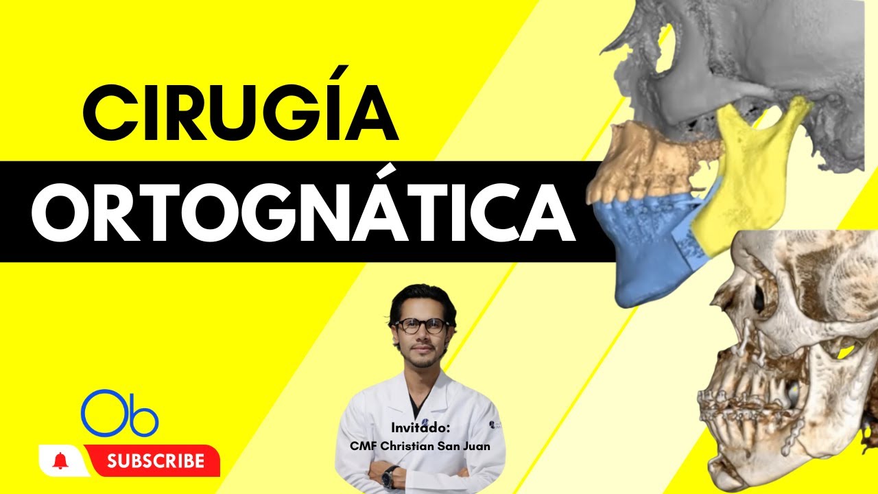 CIRUGÍA ORTOGNÁTICA con CMF Christian San Juan
