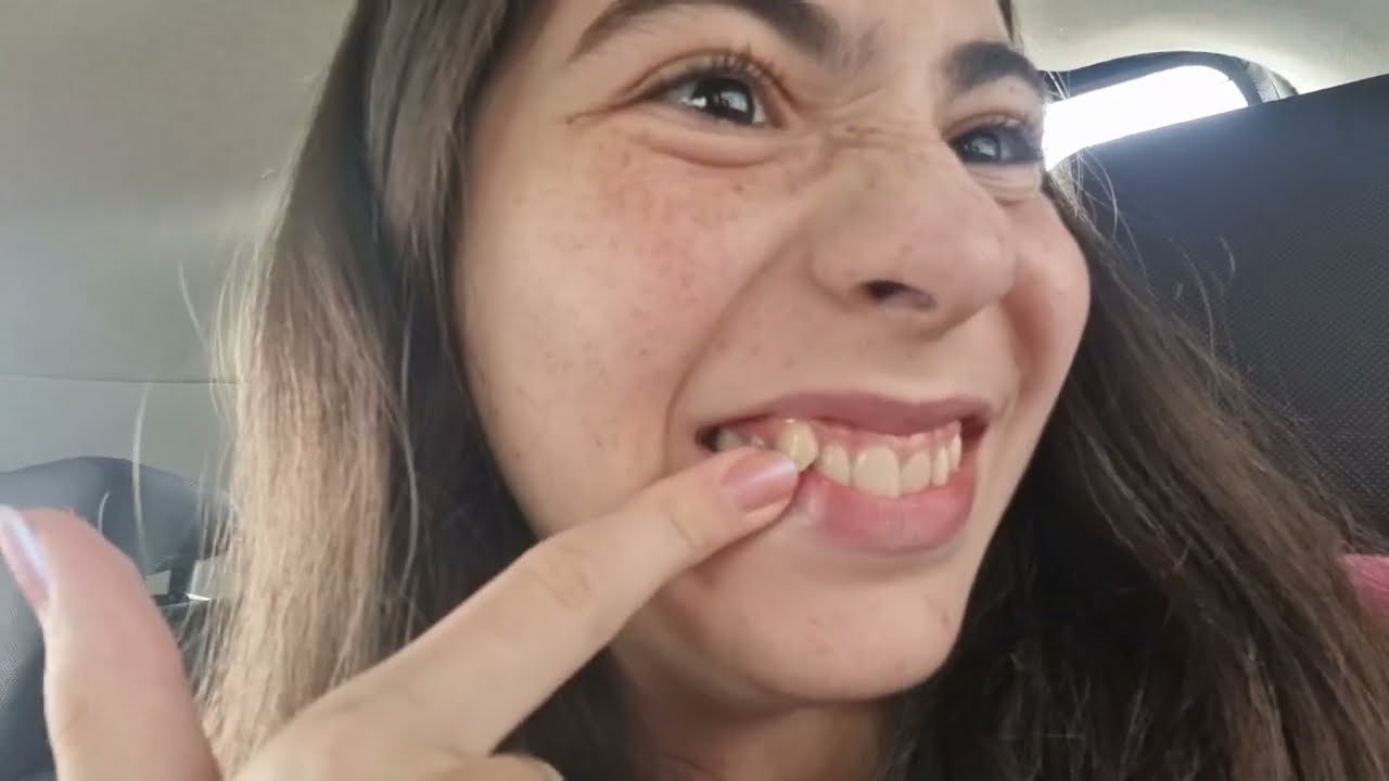 COLOQUEI APARELHO! VLOG INDO AO DENTISTA