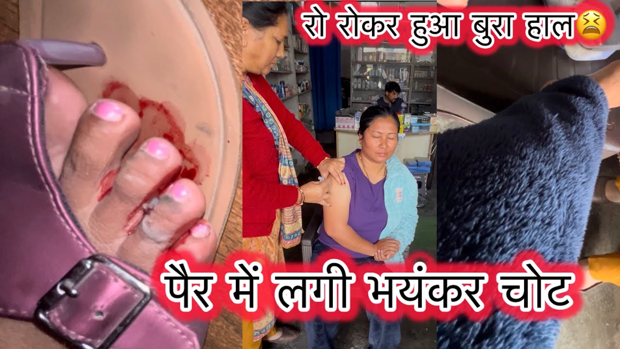 अचानक पैर पर गिरी स्कूटर 🛵 पैर की अंगुली से खून निकलने लगा आस पास कोई भी नहीं था 🥲