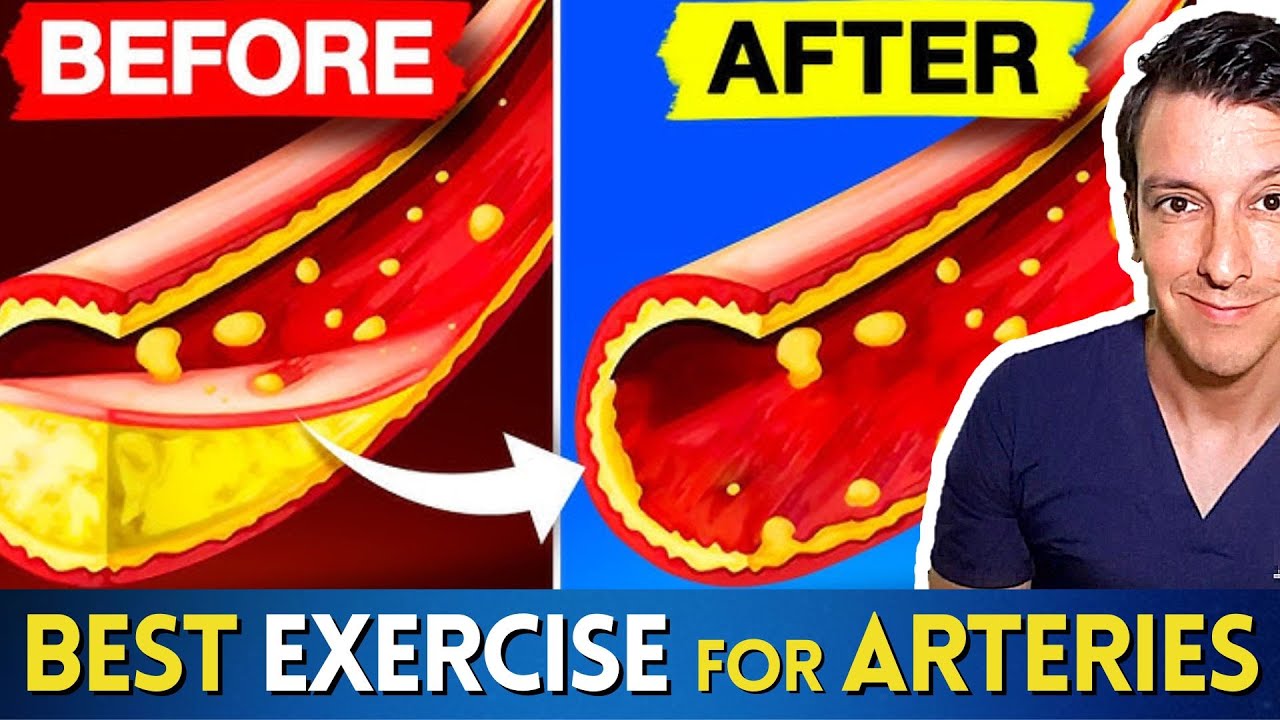 Лучшая тренировка для очищения артерий (HIIT против обычного кардио)