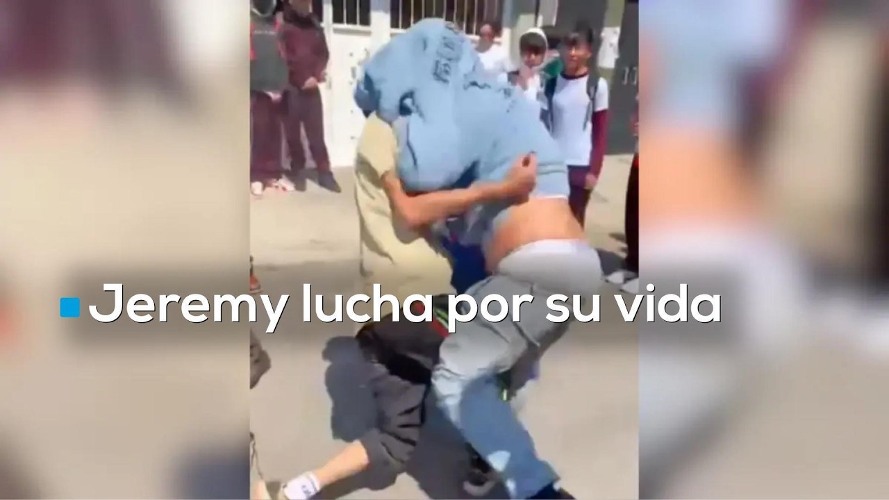 &iexcl;EL RETRATO DE UN PA&Iacute;S ENTERO! | Jeremy fue atacad0 en su secundaria en CDMX; lucha por su vida