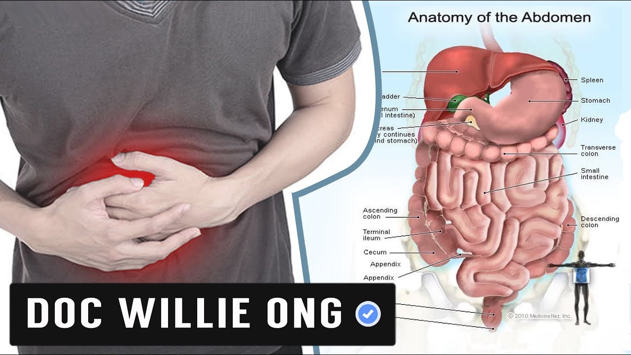 Tips sa LBM, Diarrhea, Pagtatae - Payo ni Doc Willie Ong #477b