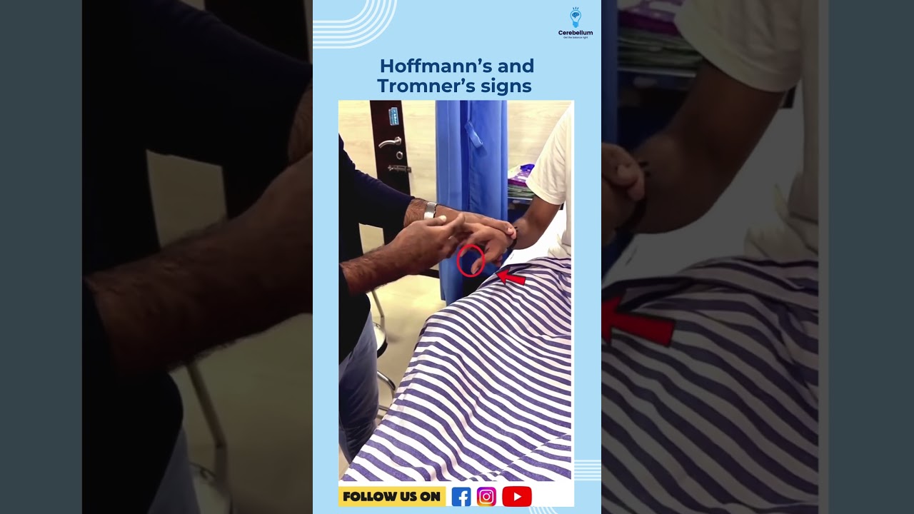 Hoffmann&rsquo;s and Tromner&rsquo;s signs | Dr. Dilip Kumar #neetpg2025 #inicet