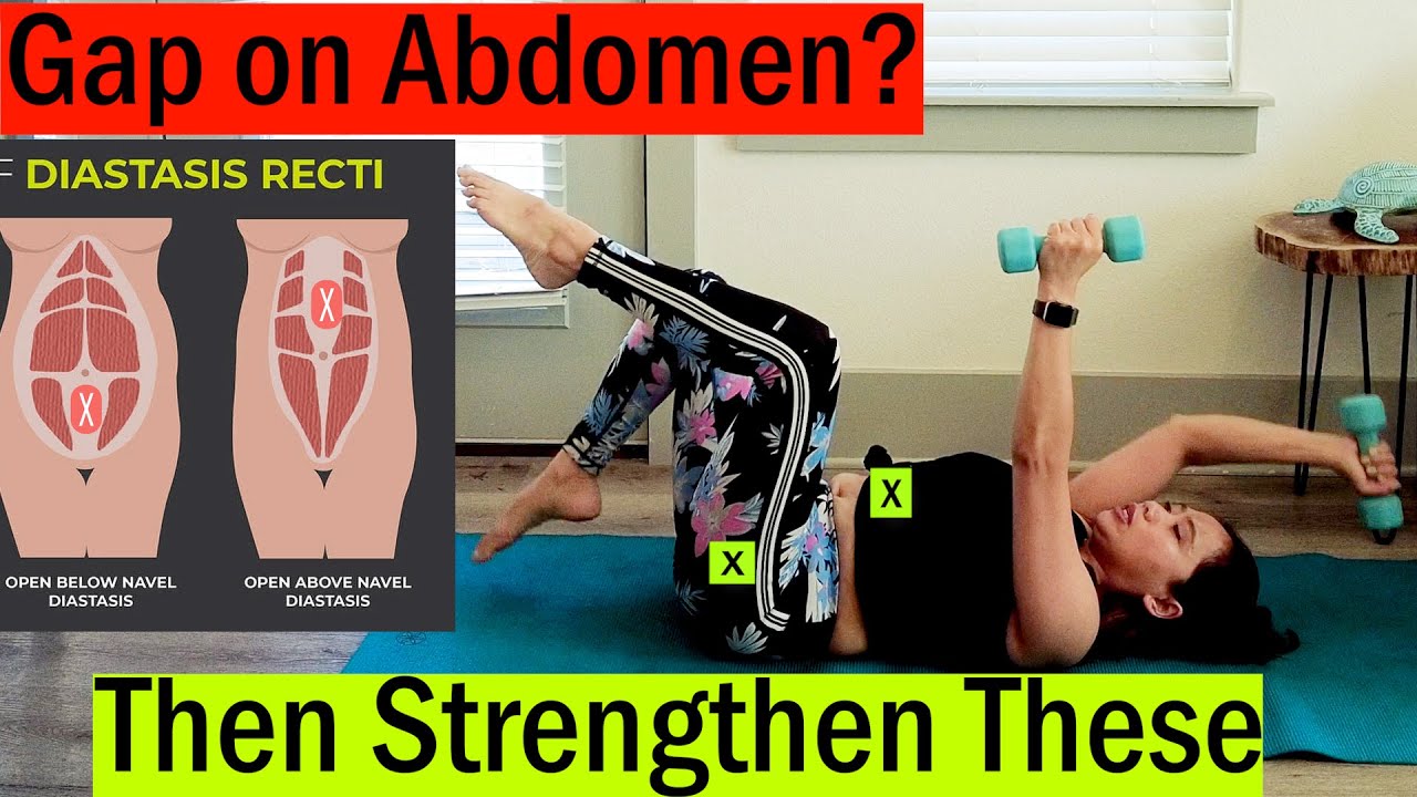 Close The Gap: The Ultimate Postpartum Diastasis Recti Program With Dumbbells Under 20 minutes a Day