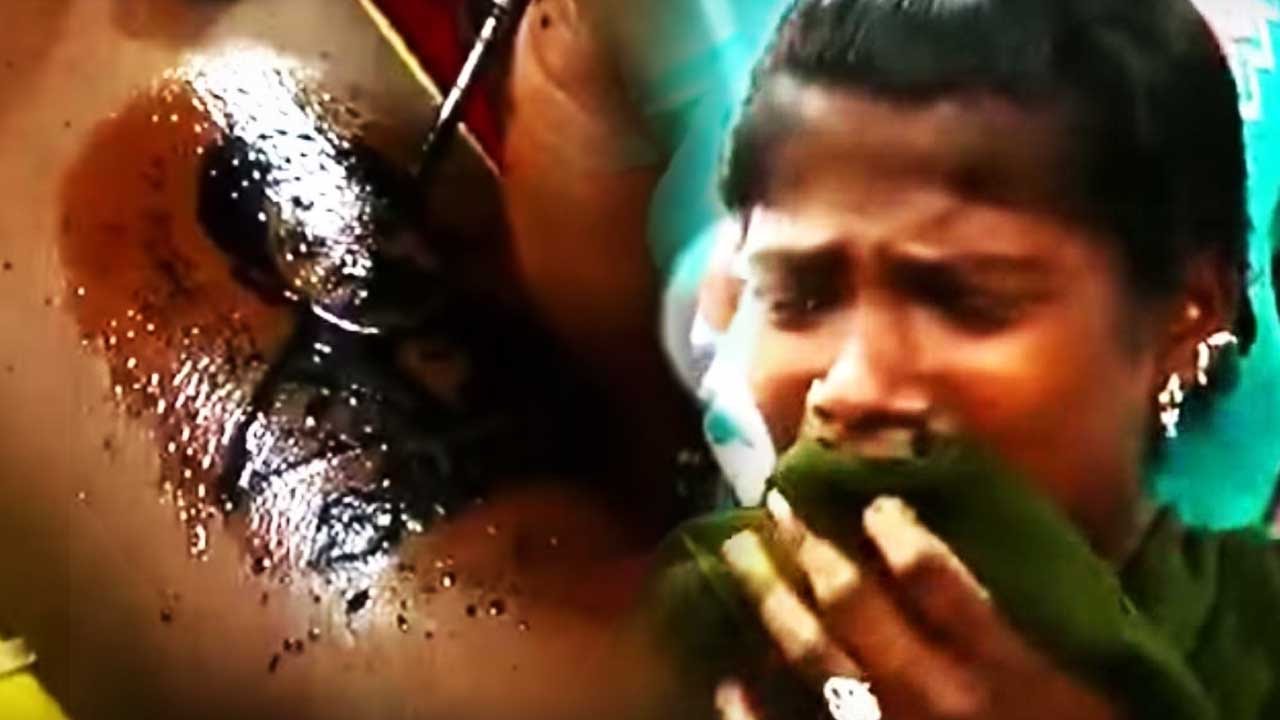 Jayalalitha tattoo forced on girl by AIADMK members, complaint goes to NHRC