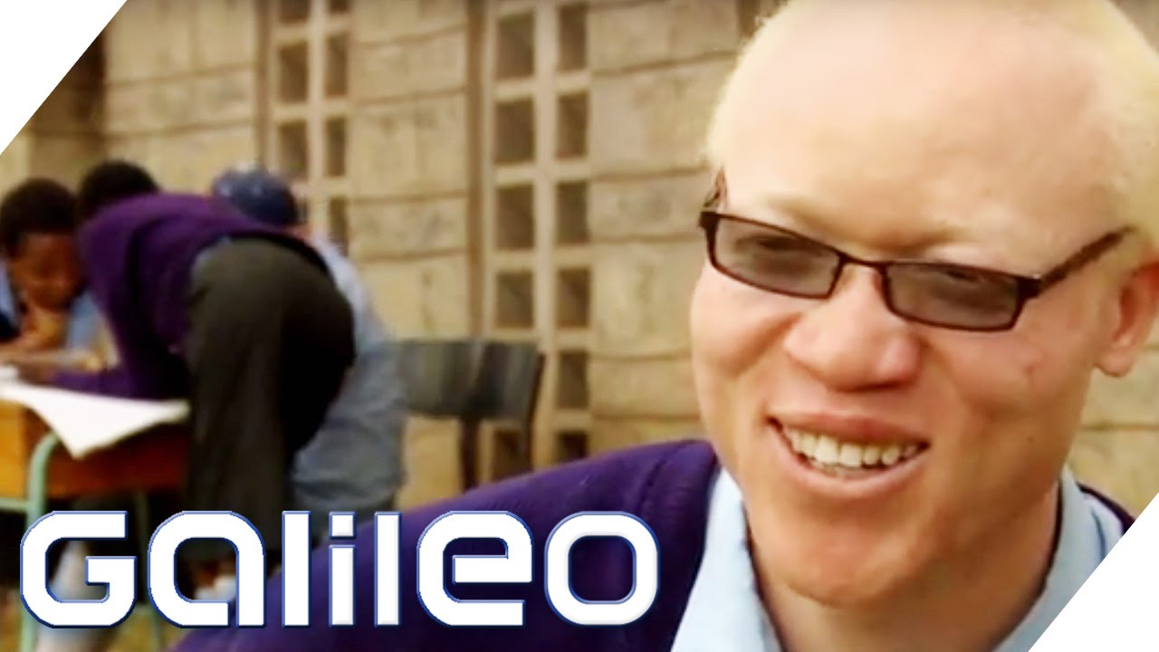 Albinos in Afrika | Galileo | ProSieben