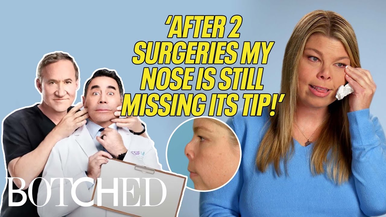 Mellissa's Nose Is Missing Its Tip Even After Multiple Surgeries?! (Before & After) | Botched | E!