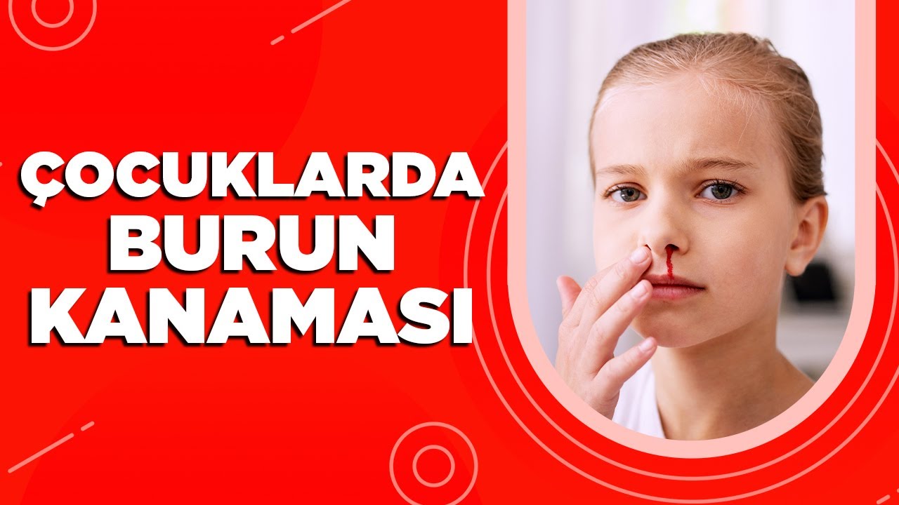 Çocuklarda Burun Kanaması Nedenleri - Epistaksis Nedir?