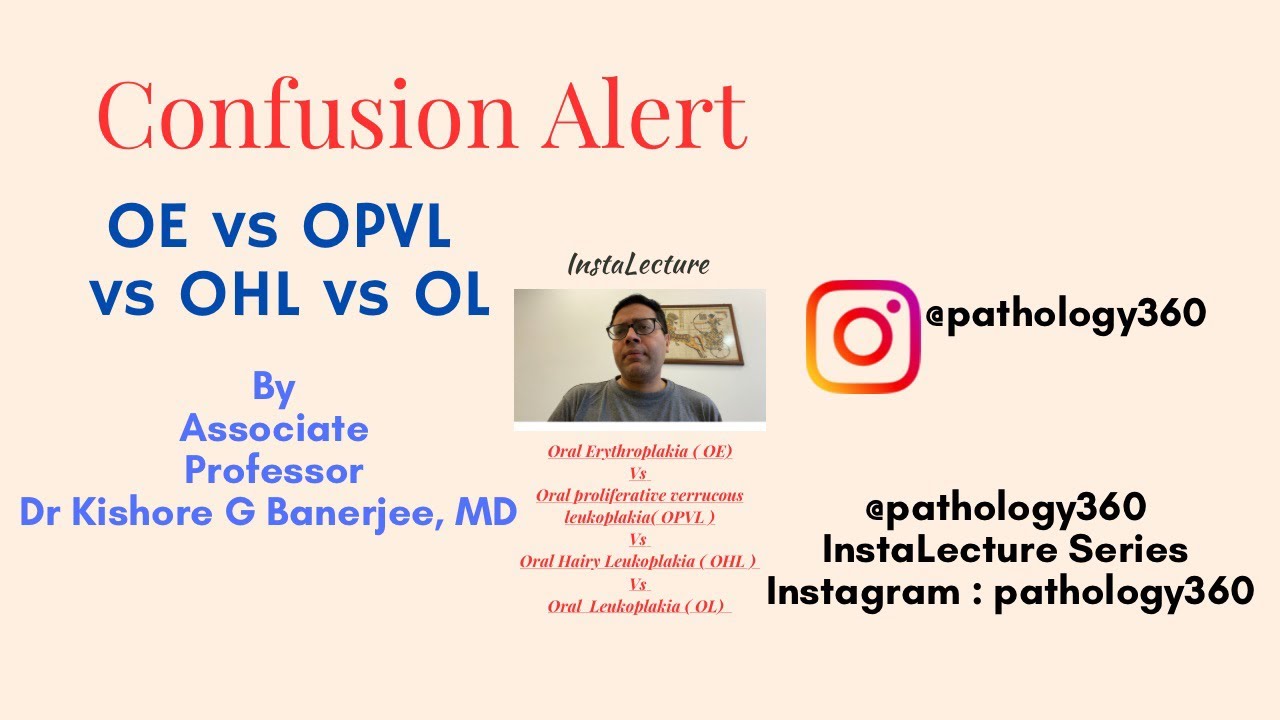 Oral Leukoplakia Vs Erythroplakia Vs Oral Hairy Leukoplakia Vs OPVL : key differences