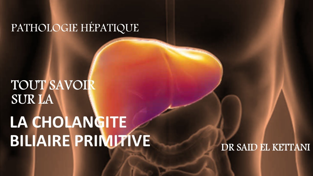 Tout savoir sur la cholangite biliaire primitive