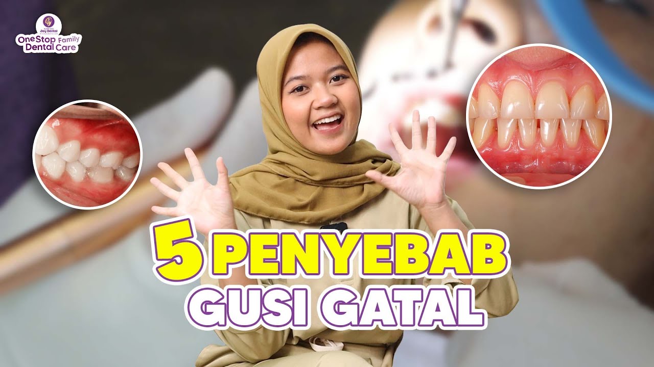 SPILL CARA NYEMBUHIN GUSI GATAL