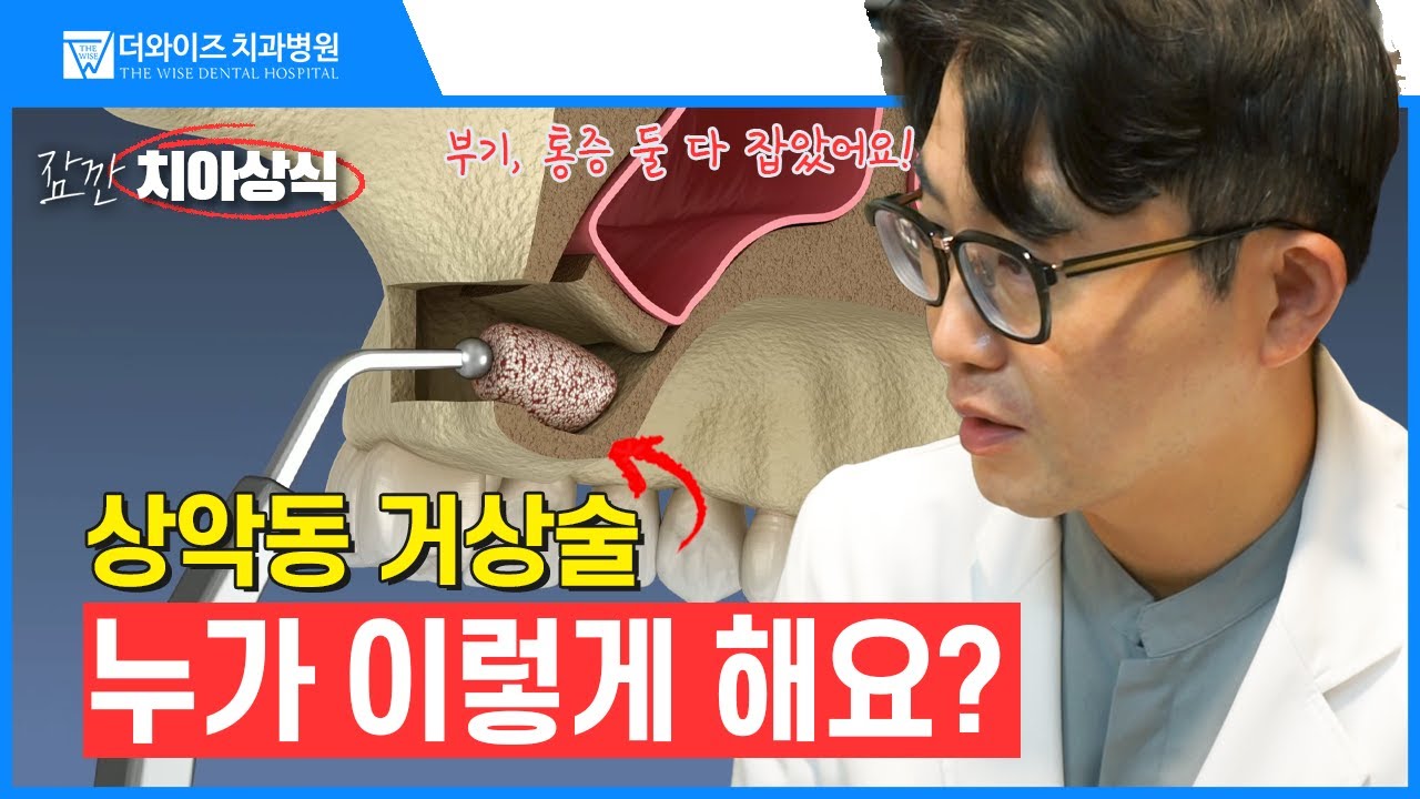 상악동 거상술, 절개 없이 10분이면 끝인데 아직도 망설이시나요?