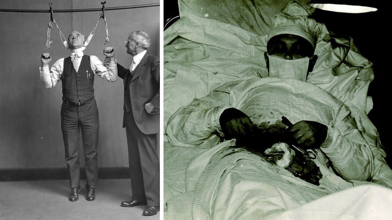 10 Disturbing Vintage Medical Photos That Will Freak You The F Out