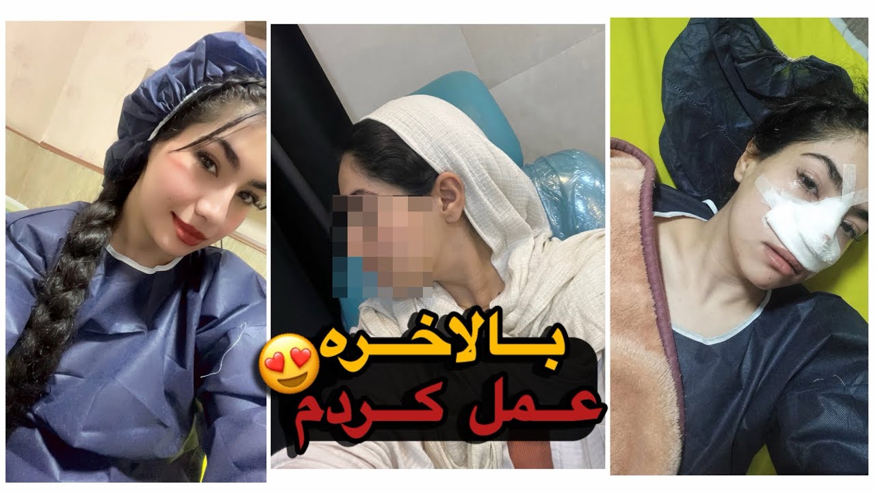 ولاگ عمل بینی👃🏻-بینیم بعد عمل چه شکلی شده؟