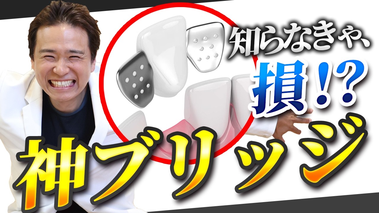その手があったか！前歯に超歯に優しい“接着ブリッジ”のメリットとデメリット