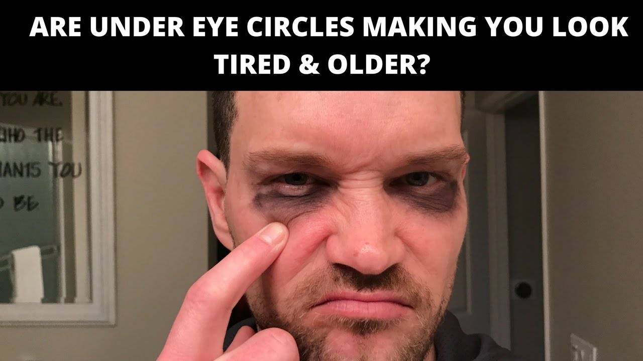HOW TO BRIGHTEN AND TIGHTEN UNDER EYE CIRCLES AND EYELIDS