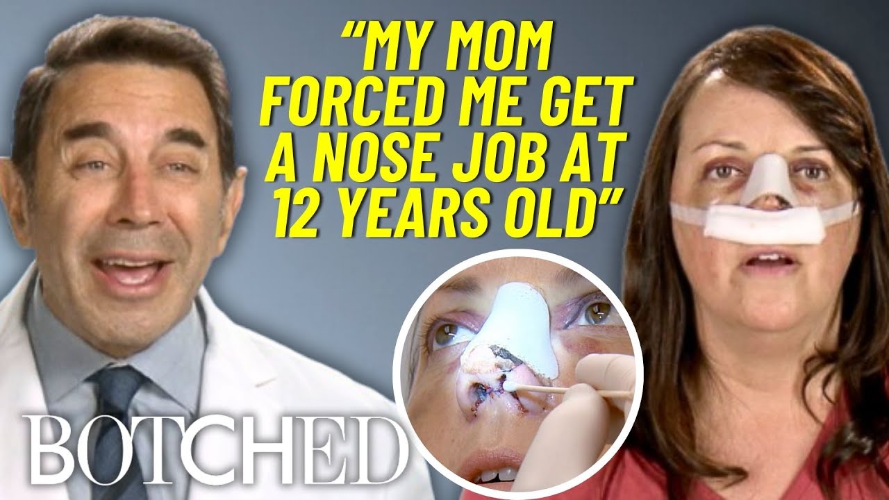 Cindy’s Wants To Look Like Her Identical Twin Again After Botched Nose Job | Botched | E!